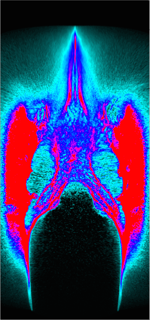 Ion Beam Wenlong Zhang